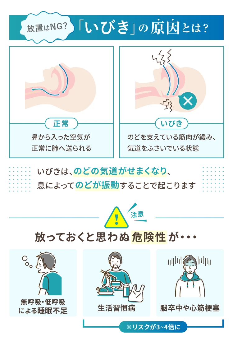 スノアレーズ